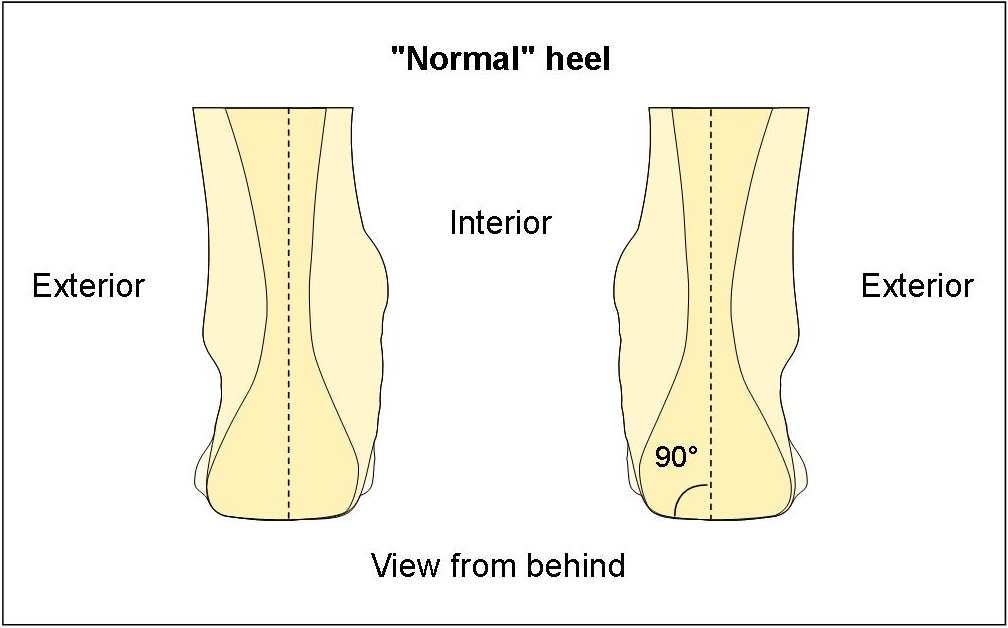 Angle of normal heel