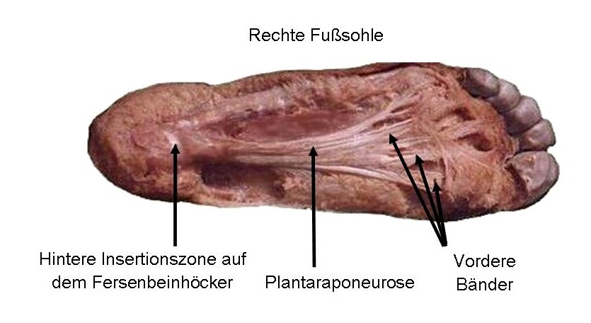 Plantaraponeurose