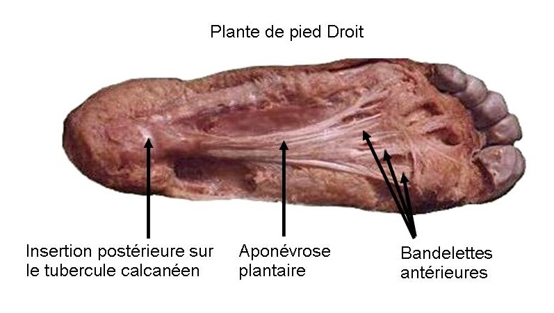 Aponévrose plantaire