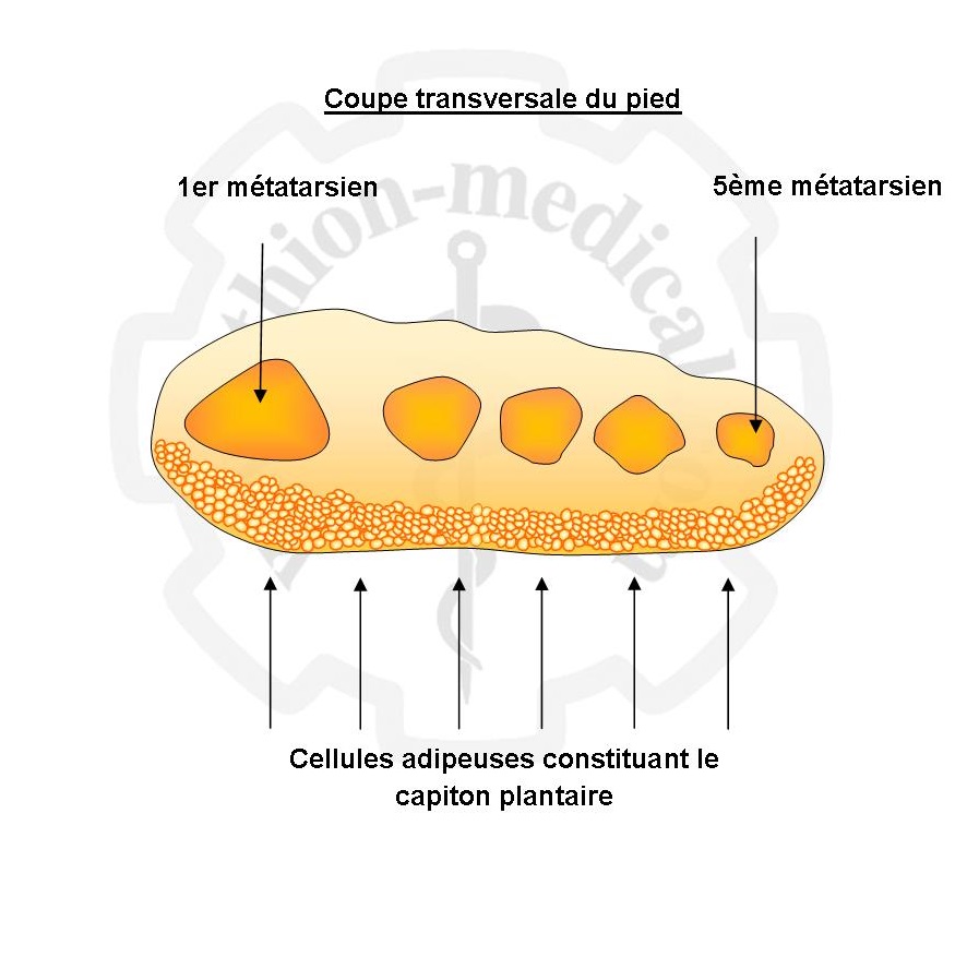 Acheter Manchons de soutien de la voûte plantaire pour soulager la douleur  du pied plat, coussinet de pied en Gel élastique doux rembourré, Inserts  d'éperon de talon