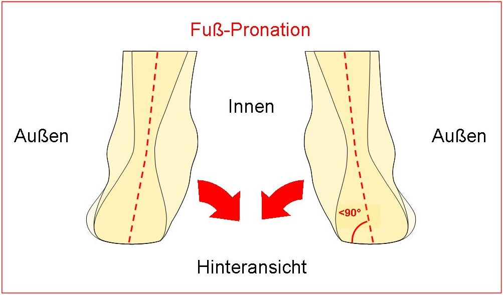 Schema  Fuß-Pronation