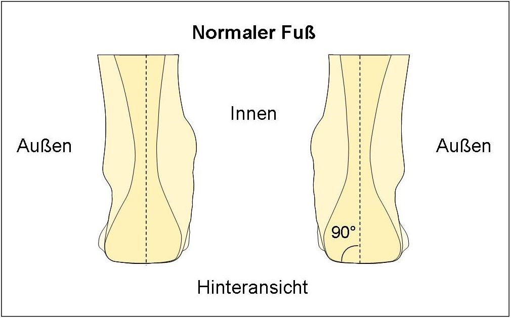 Schema Normaler Fuß
