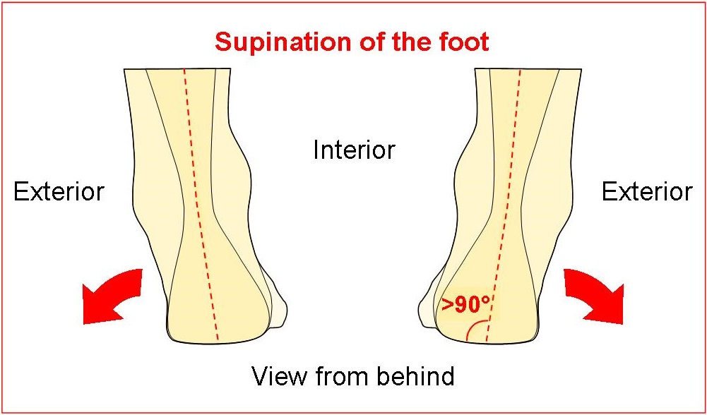 Supination of the foot