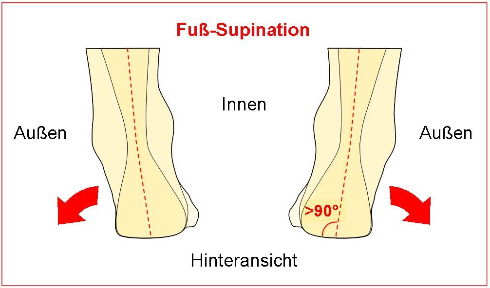 Fuß-Supination
