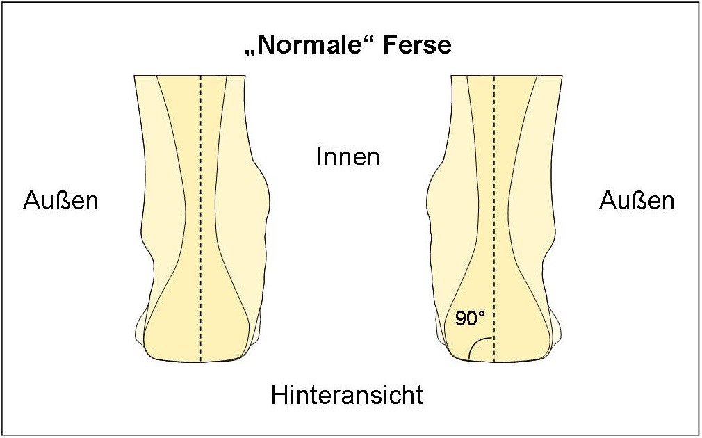 Winkel einer normalen Ferse