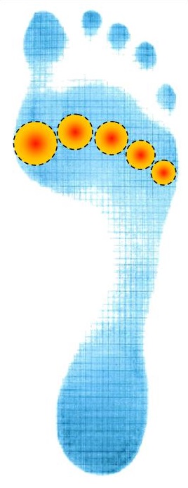 Zone de douleurs des articulations de tous les orteils